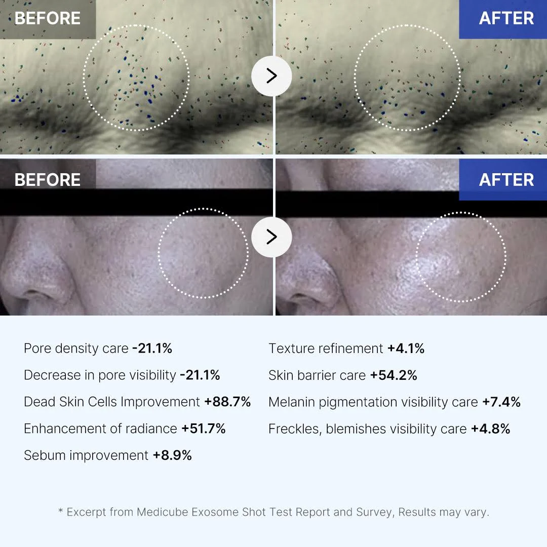 Concentrated exosome ampoule that regenerates skin, improves firmness, and restores radiance with professional-level results in just one application.