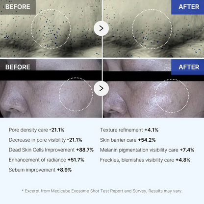 Concentrated exosome ampoule that regenerates skin, improves firmness, and restores radiance with professional-level results in just one application.